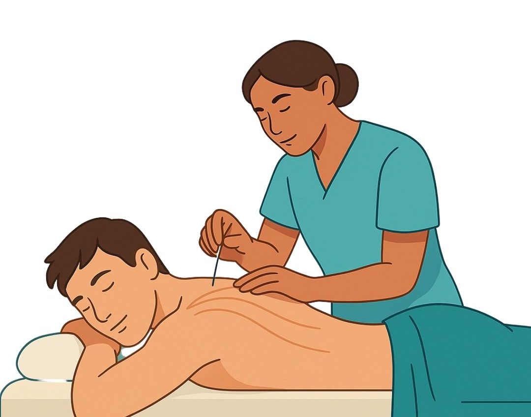 Dry Needling Therapy